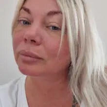 Foto Mila 1 